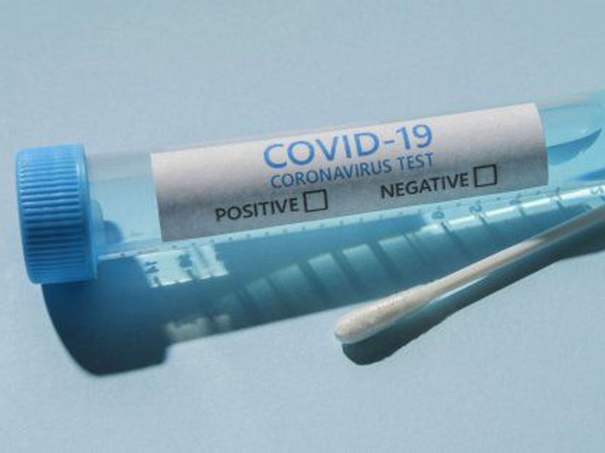 Covid-19 Uzès : mise en place d’une cellule de dépistage rapide à Pautex